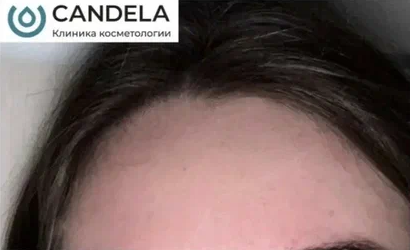 Постакне Nordlys Candela