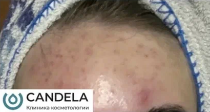 Постакне Nordlys Candela